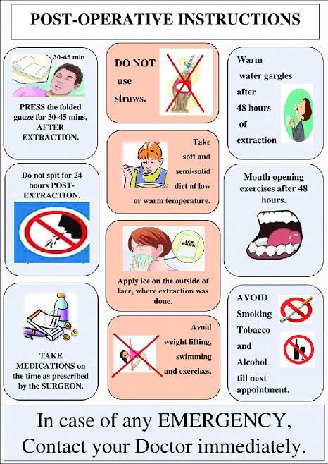 Things-to-Avoid-After-Tooth-Extraction-The-Full List