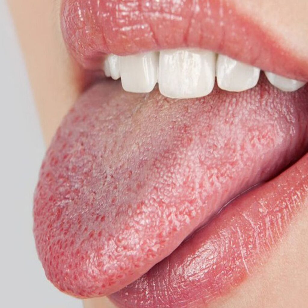 FOODS-THAT-INCREASE-SALIVA-PRODUCTION