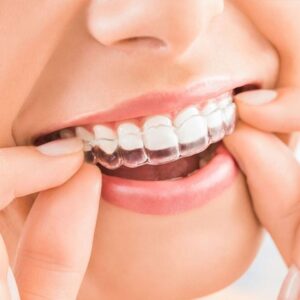 How-much-is-Invisalign-cost-2026-clear-aligner-treatment-price-breakdown