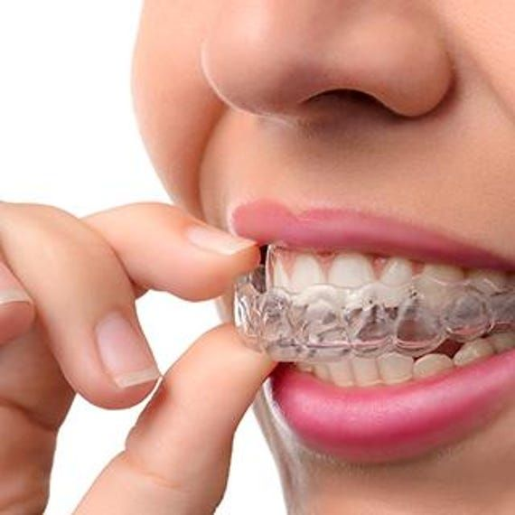 Average-Invisalign-cost-2026-US-price-range-3000-to-8500-dollars