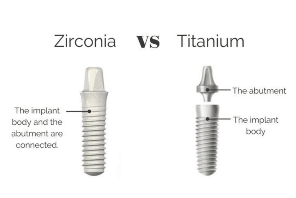 Zirconia-Tooth-Implant