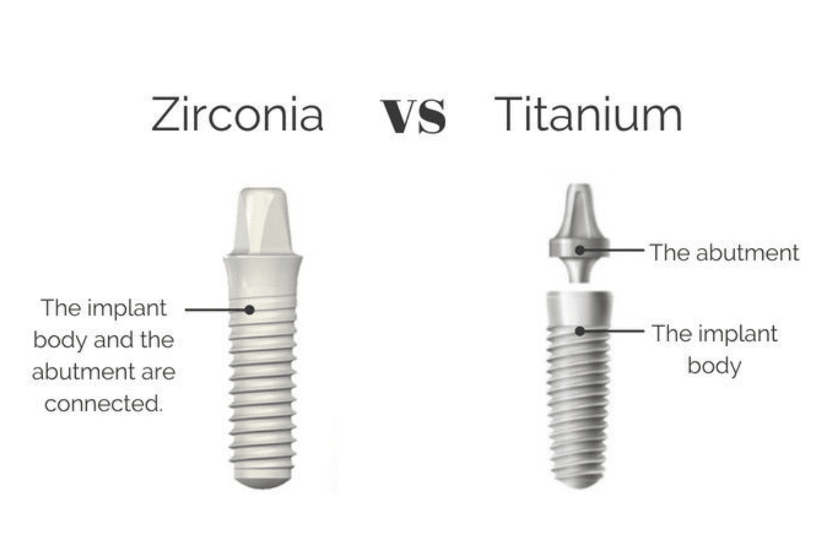 Zirconia-Tooth-Implant
