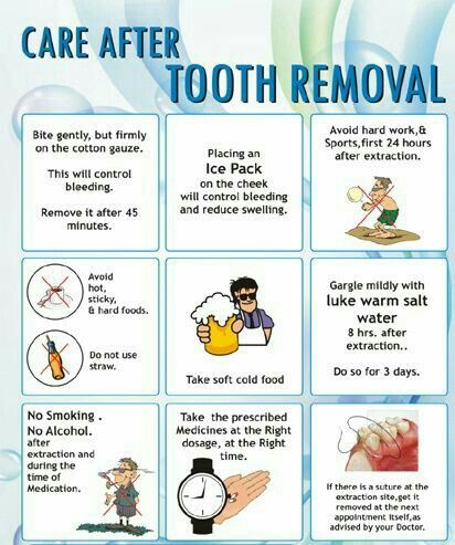 things-to-avoid-after-tooth-extraction