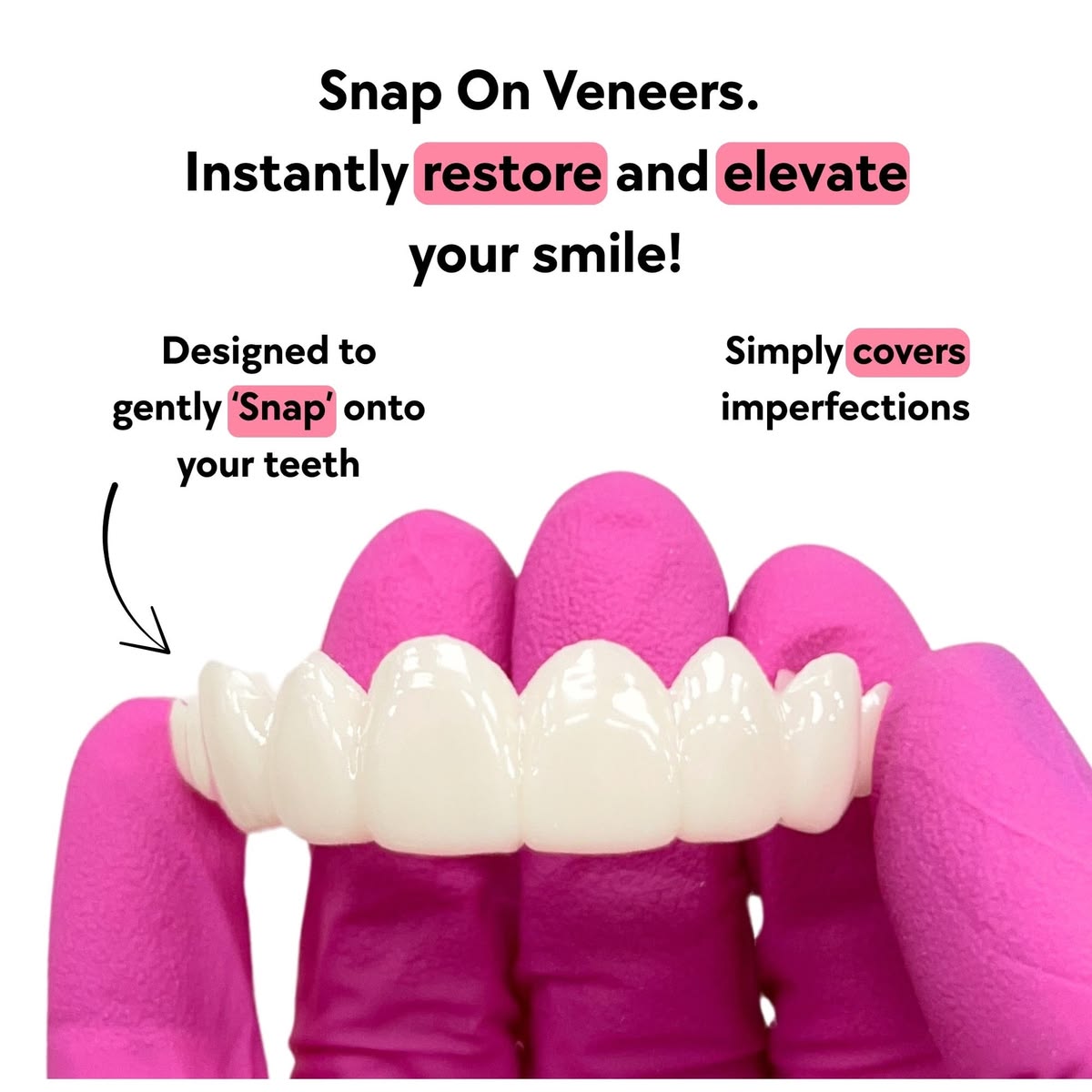 what-are-snap-on-veneers