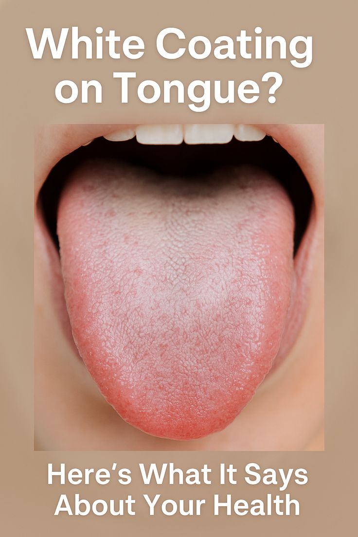 white-color-on-tongue