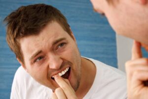 Loose-Tooth-in-Adults