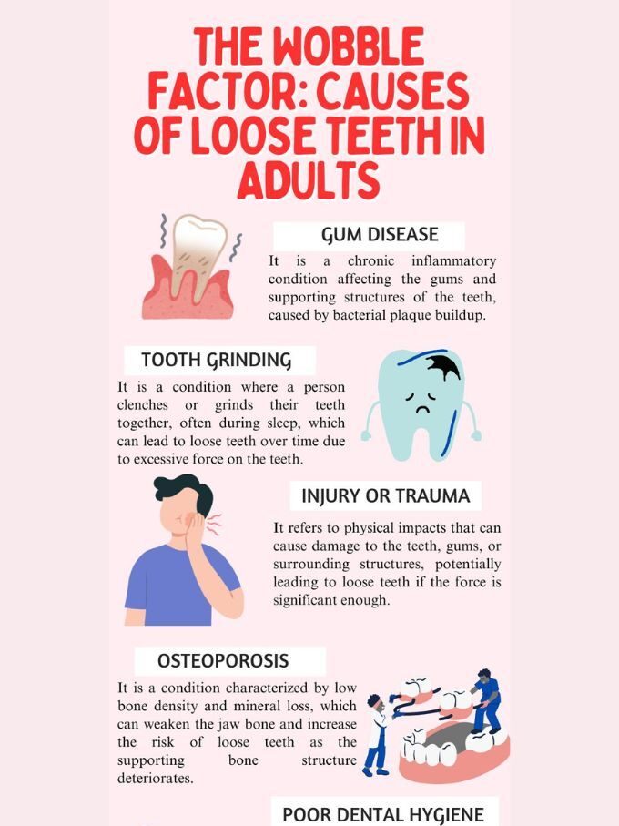 The-Wobble-Factor-Causes-of-Loose-Teeth-in-Adults