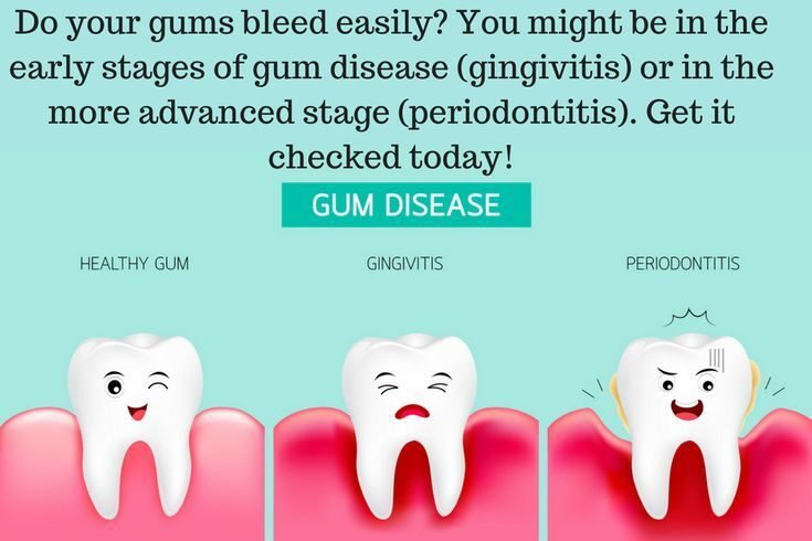 gum-disease