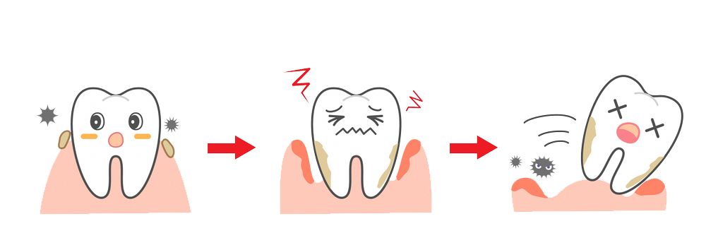 stages-of-a-loose-tooth